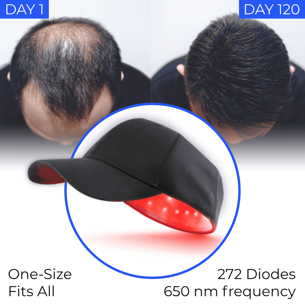 Nordic™ Laser Therapy Cap